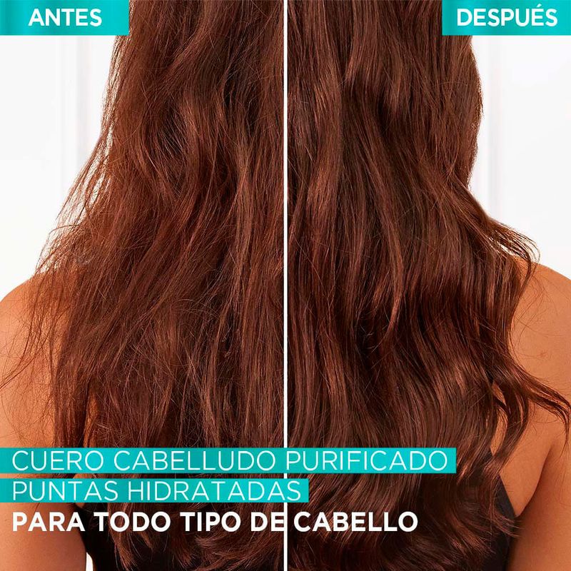 Pack-Elvive-Hialur-nico-Pure-Shampoo-Acondicionador-Mascarilla-5-241732