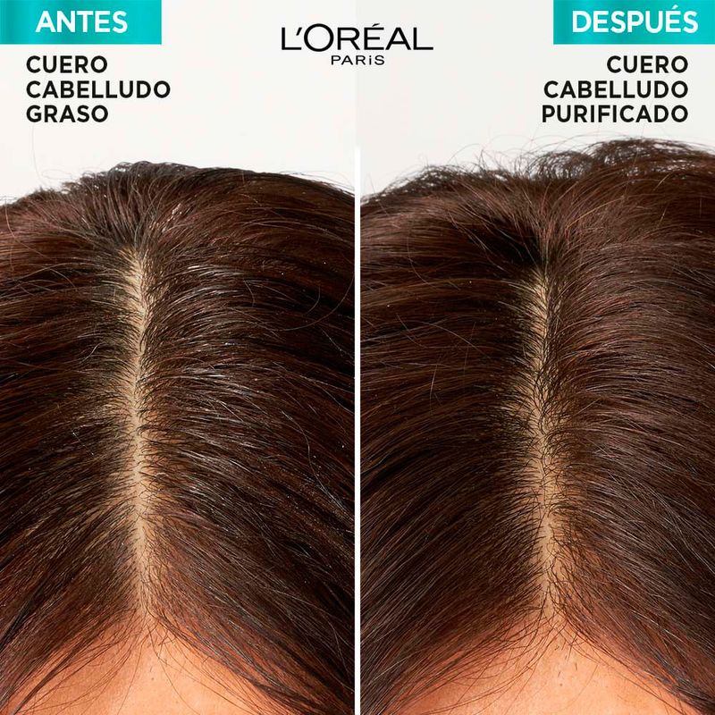 Pack-Elvive-Hialur-nico-Pure-Shampoo-Acondicionador-Mascarilla-6-241732